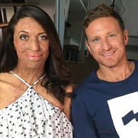 Vor 6 Jahren bei einem Ultramarathon fast verbrennt - nun ist Turia Pitt schwanger!