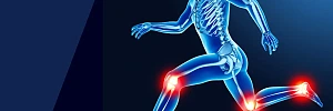 Das Thema Gelenksgesundheit ist beim Laufen sehr umstritten.